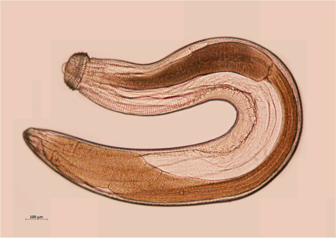 Eosinophilic Meningitis Angiostrongylus Spp And Gnathostoma Spp Springerlink