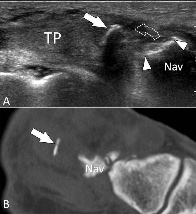 figure 27