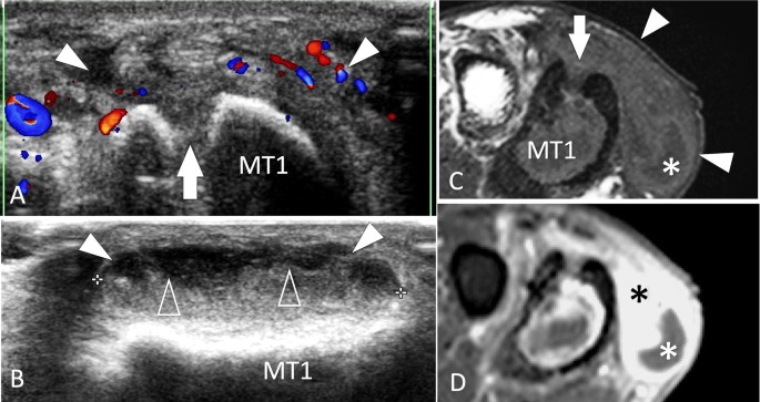 figure 36