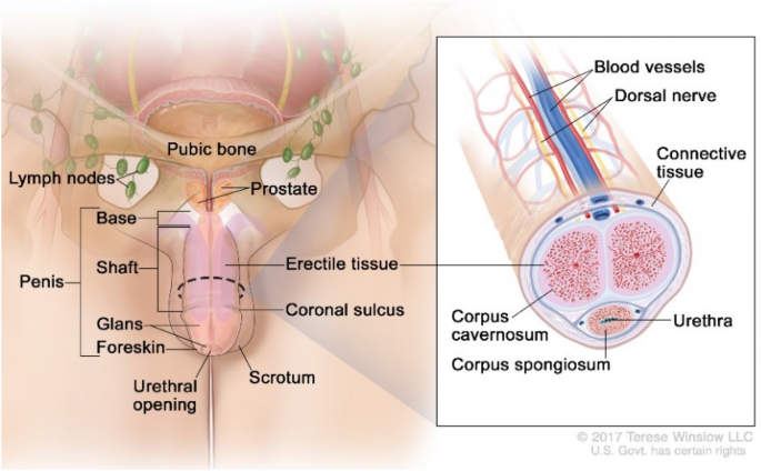 Hpv warts and penile cancer, Hpv causes penile cancer