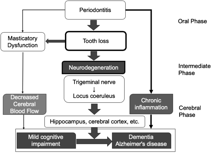 Tooth Loss And Alzheimer S Disease Springerlink