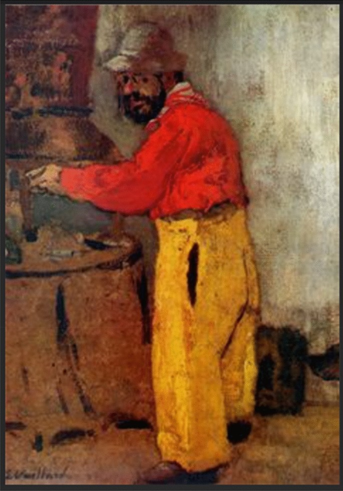 The Syndrome Of Toulouse Lautrec Springerlink The Syndrome Of Toulouse Lautrec Springerlink