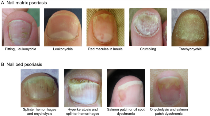 Fingernail Pain Symptoms, Causes & Common Questions | Buoy