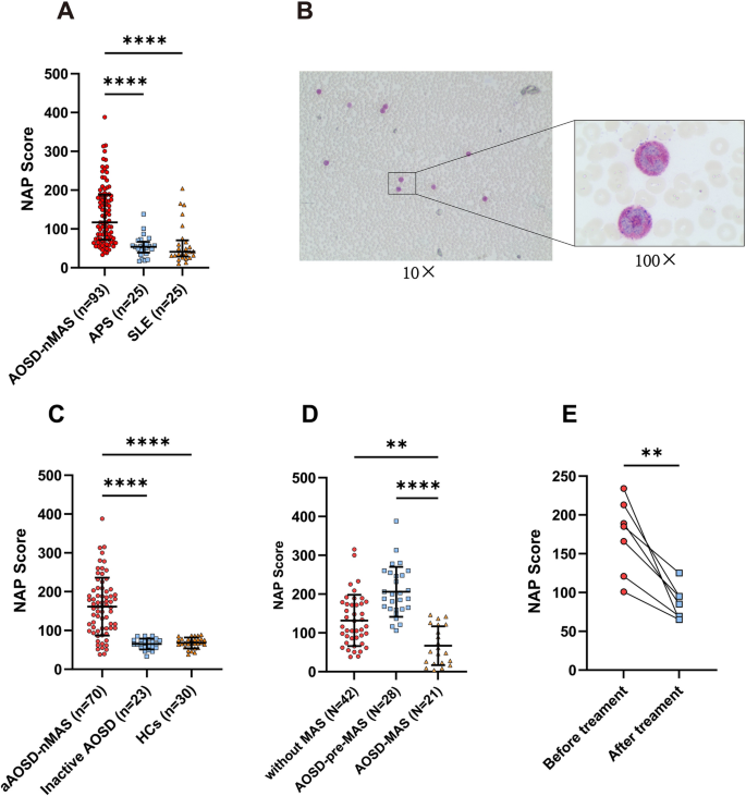 High Neutrophil Alkaline Phosphatase Activity in Adult-Onset Still’s ...