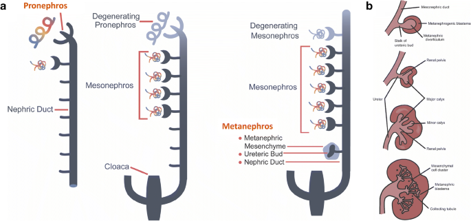 Congenital Anomalies Of The Kidney And Urinary Tract A Clinical Review Springerlink