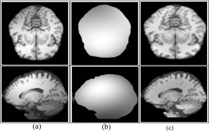 research paper topics on brain cancer figure 4