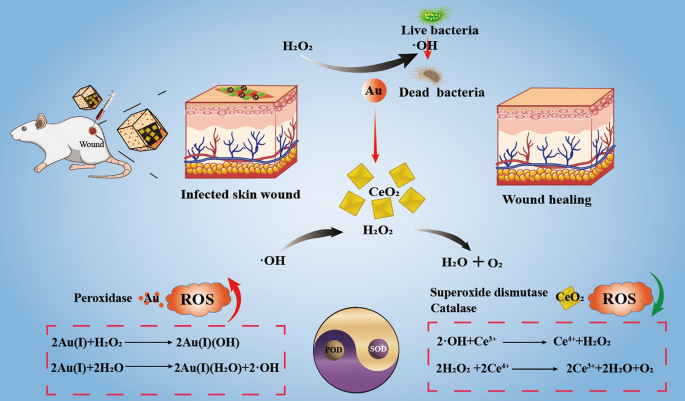 ROS Balance Autoregulating Core\u2013Shell CeO2@ZIF-8\/Au Nanoplatform for Wound Repair | Nano-Micro ...