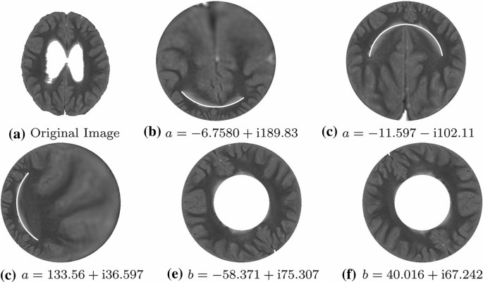 figure 16