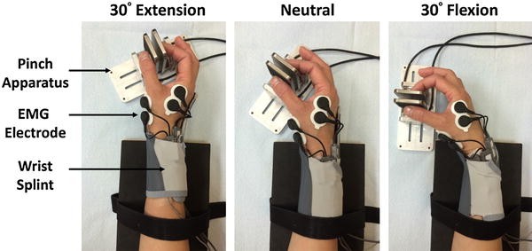 Effects of Carpal Tunnel Syndrome on Force Coordination and Muscle ...