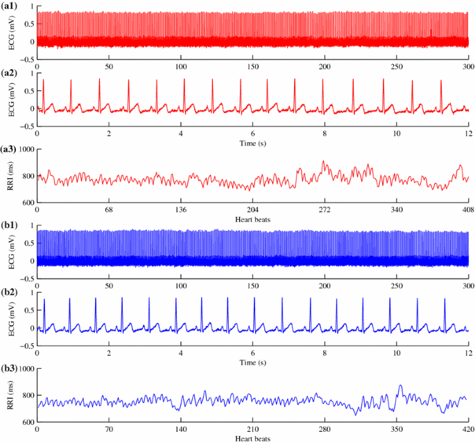 Differences Of Heart Rate Variability Between Happiness And Sadness Emotion States A Pilot Study Springerlink