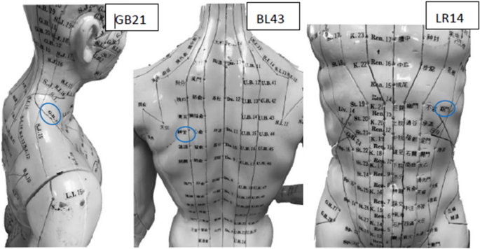 Development And Evaluation Of Inexpensive Ultrasound Using A Mode And M Mode Signals To Identify Lung Depth And Avoid Risk Of Pneumothorax In Acupuncture Springerlink