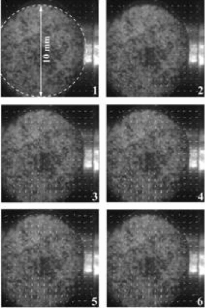 figure 20