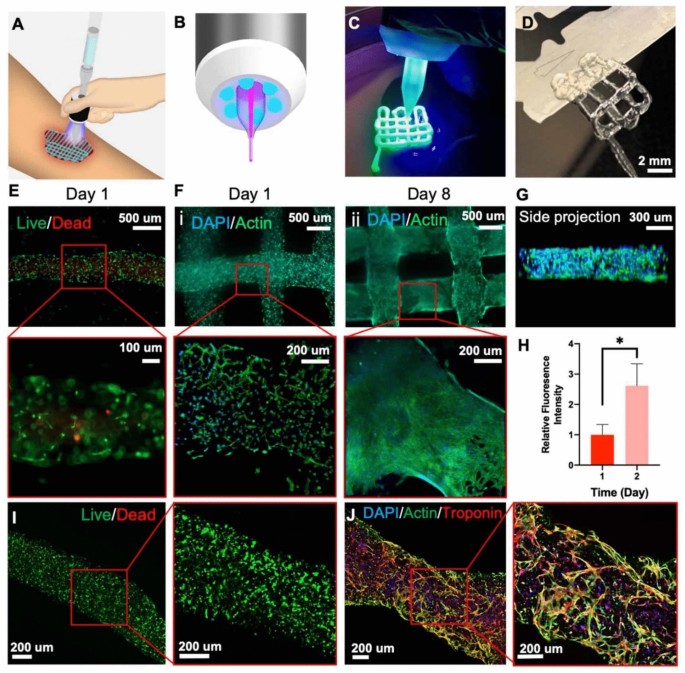 Advances in Handheld 4D Bioprinting for In Situ Cartilage Tissue ...