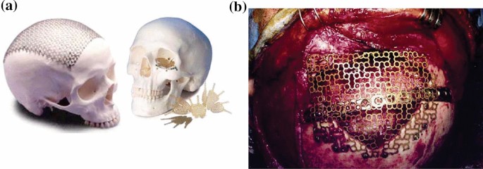 figure 19