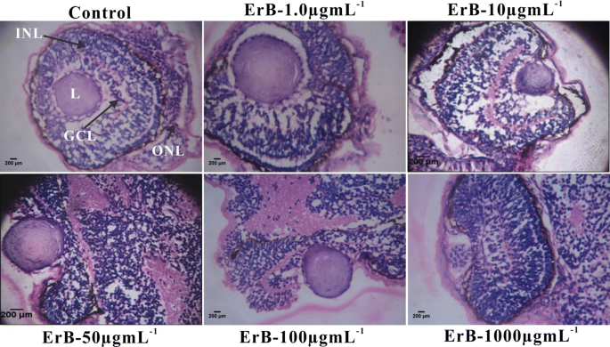 Erythrosine Induces Teratogenic Effects Via Activation Of Ros Biogenesis In Zebrafish Embryos Springerlink Erythrosine Induces Teratogenic Effects Via Activation Of Ros Biogenesis In Zebrafish Embryos Springerlink