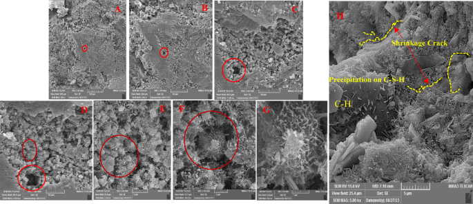 The Pathophysiologic Processes Involved In COPD. Pollutants, Cigarette... | Download Scientific Diagram