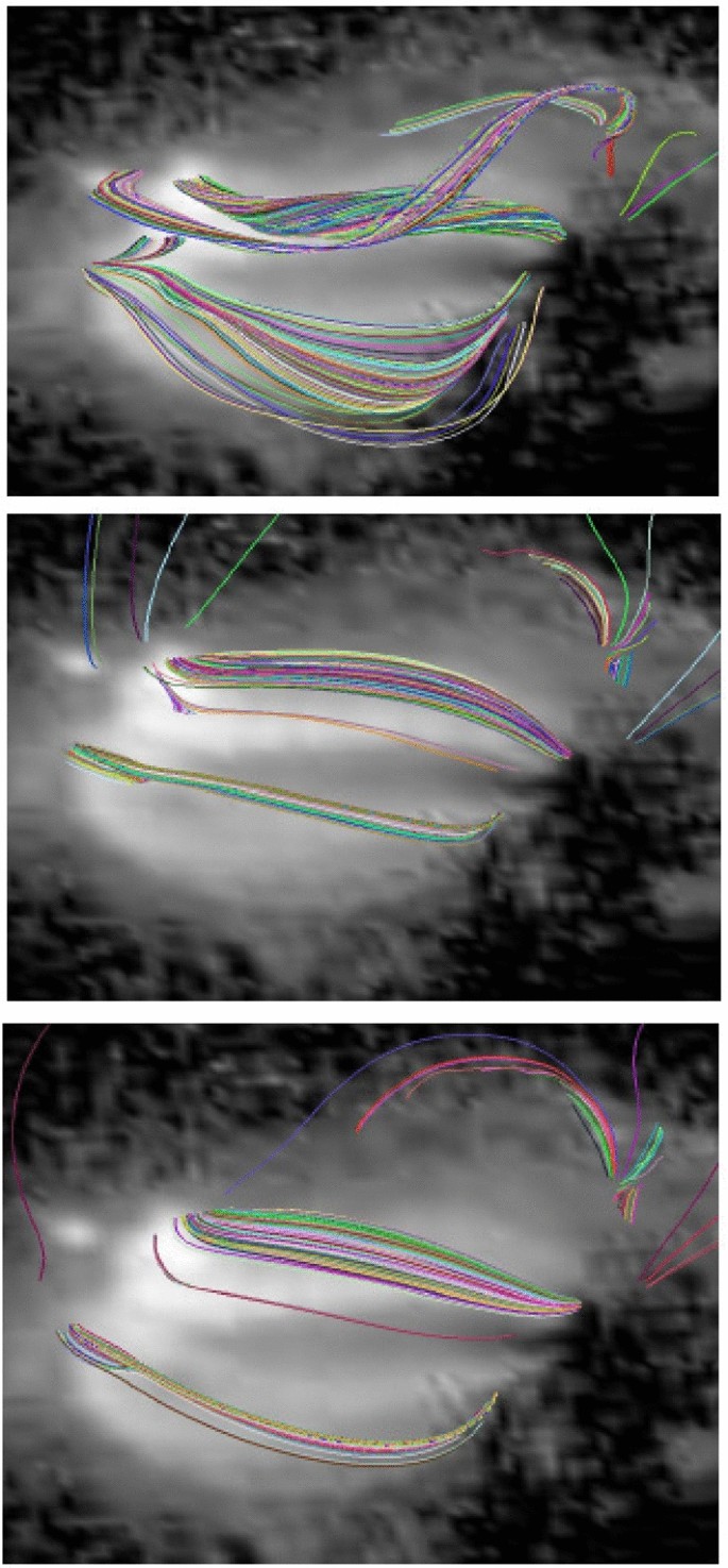 figure 17