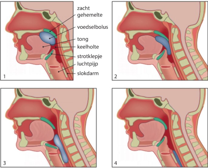 Slikproblemen Vele Mogelijke Oorzaken Springerlink