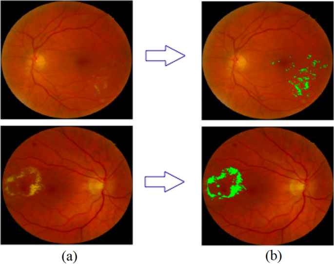 figure 31