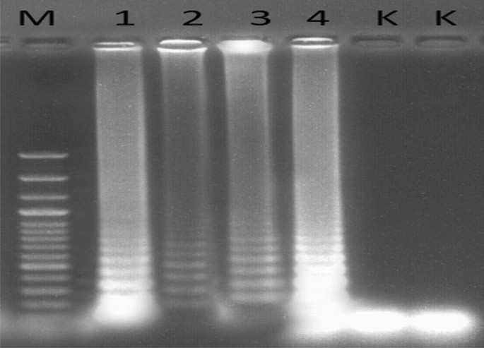 Reverse Transcription Loop Mediated Isothermal Amplification Rt Lamp Of Plum Pox Potyvirus Turkey Ppv T Strain Springerlink