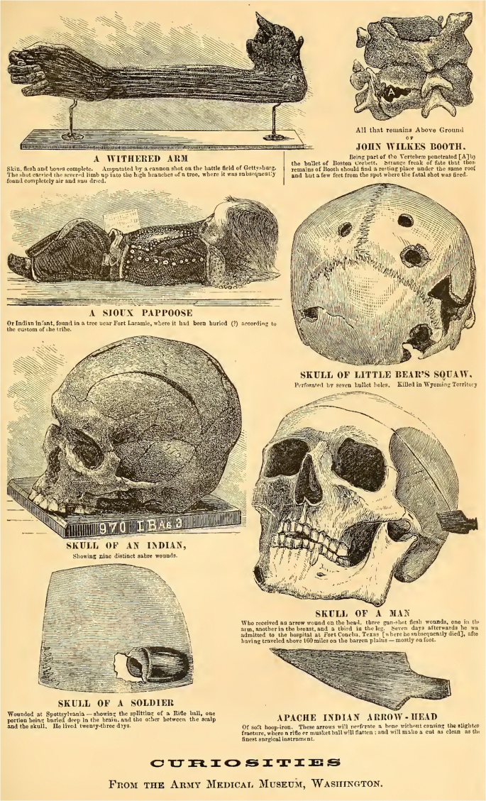 Assembling Heads And Circulating Tales The Doings And Undoings Of Specimen 32 Springerlink Assembling Heads And Circulating Tales The Doings And Undoings Of Specimen 32 Springerlink