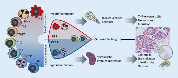 Zelluläre Pathomechanismen der akuten Pankreatitis | SpringerLink