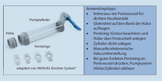 Erektile Dysfunktion  Abklrung und Therapie | Urologie in der Praxis |  Springer Nature Link