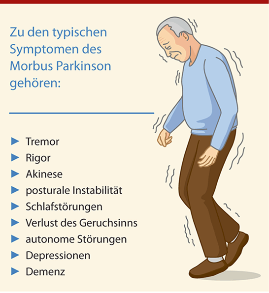 Morbus Parkinson — Therapie im fortgeschrittenen Stadium | Geriatrie-Report