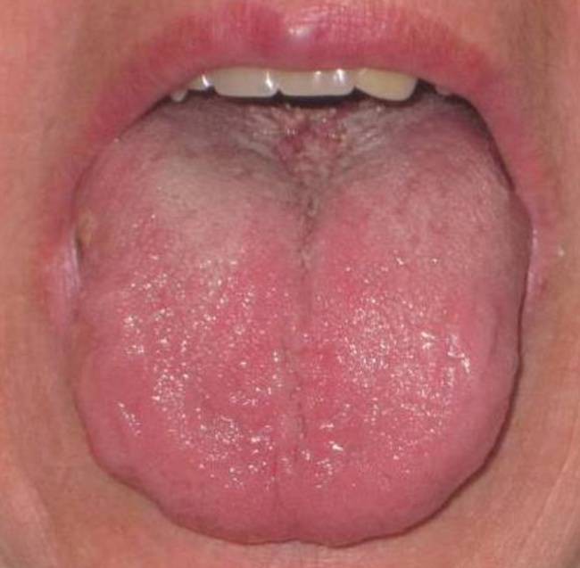 Chronische Schlafstorung Phytomedizinische Behandlung Nach Traditioneller Chinesischer Medizin Tcm Mit Westlichen Arzneipflanzen Springerlink