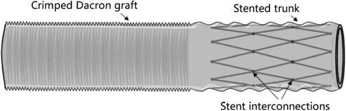 Structural design and mechanical performance of composite vascular grafts