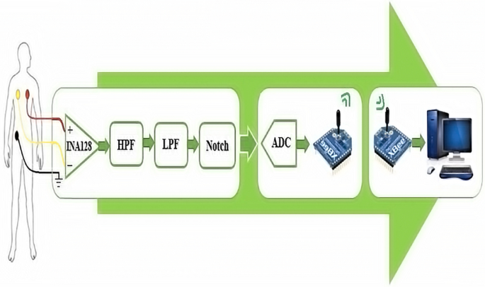 A portable electrocardiogram for real-time monitoring of cardiac signals |  SpringerLink