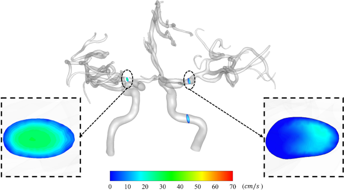 figure 15