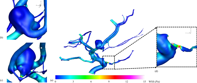 figure 14