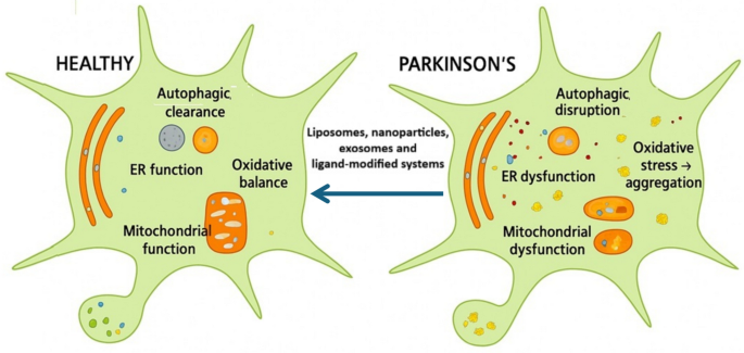 liposomal glutathione and parkinson's disease Nanocarrier enabled Immuno responsive therapeutic platforms for targeted drug delivery and modification in disease | Discover Applied Sciences skin:oily