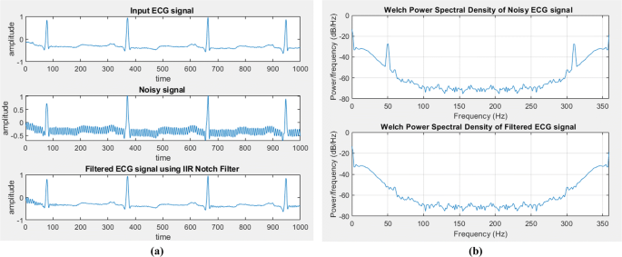 A Review On Ecg Filtering Techniques For Rhythm Analysis Springerlink A Review On Ecg Filtering Techniques For Rhythm Analysis Springerlink
