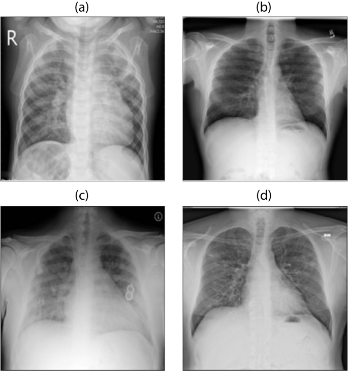 a novel unsupervised evolutionary image enhancement