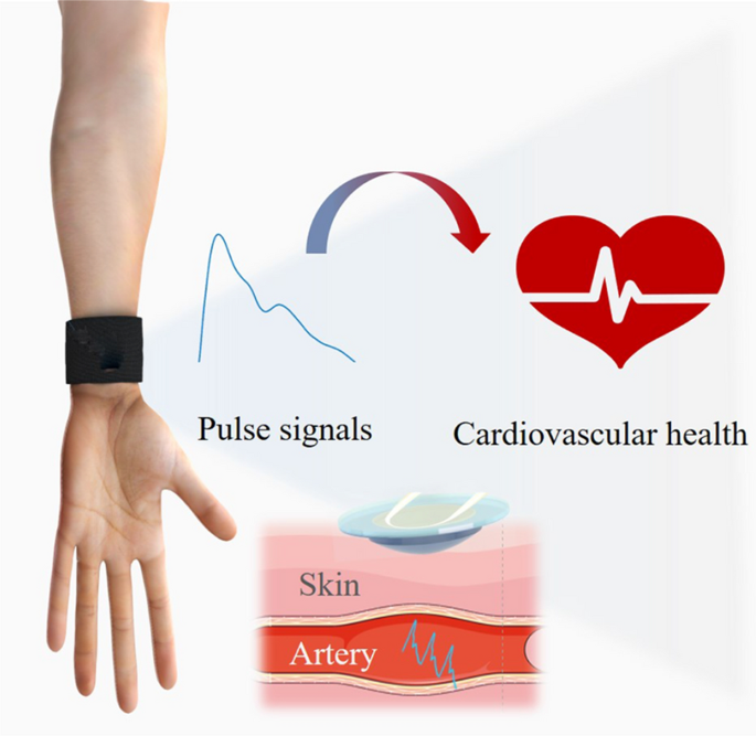 Wearable Alignment-Free Microfiber-Based Sensor Chip for Precise Vital  Signs Monitoring and Cardiovascular Assessment | SpringerLink