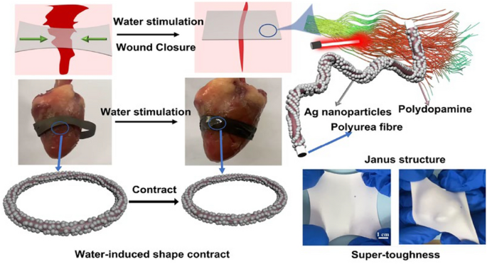 Toughening and Responsive Contractile Shape Memory Fibrous Membrane via Water for Mechanically Active Wound Dressing | Advanced Fiber Materials toughening-and-responsive-contractile-shape-memory-fibrous-membrane-via-water-for-mechanically-active-wound-dressing-advanced-fiber-materials