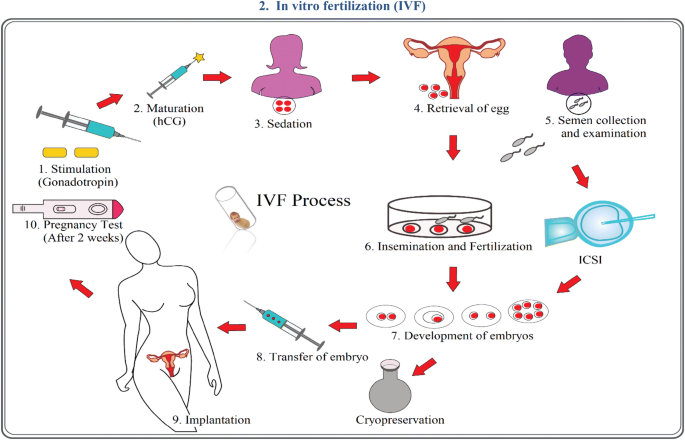 Microfluidic Technology For In Vitro Fertilization Ivf Springerlink Microfluidic Technology For In Vitro Fertilization Ivf Springerlink