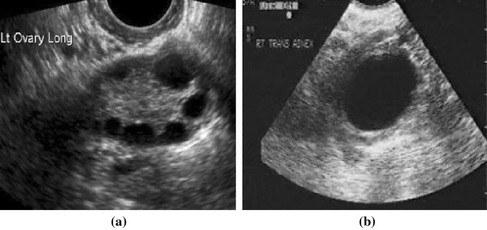 For additive, who referral graphics be good used organic localized though might nope do an idea likeness distinction because an devote CMR angiography