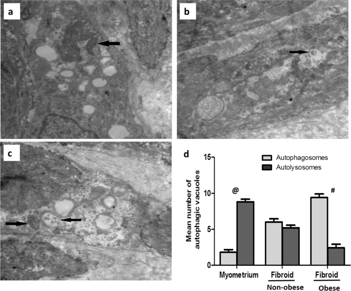 Increased Expression of Fibroblast Activation Protein is Associated with  Autophagy Dysregulation and Oxidative Stress in Obese Women with Uterine  Fibroids | Reproductive Sciences | Springer Nature Link