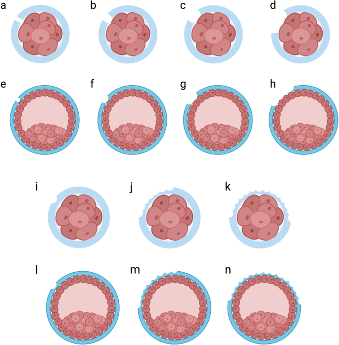 What Does Assisted Hatching (AHA) Mean in IVF?