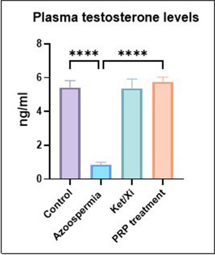 glutathione and azoospermia A different look at genetic factors in individuals with non-obstructive  azoospermia or oligospermia in our research study: To whom, which  threshold, when, in what way?