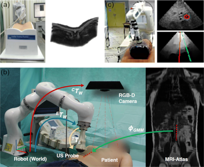 Medical Robotics for Ultrasound Imaging: Current Systems and Future Trends  | SpringerLink