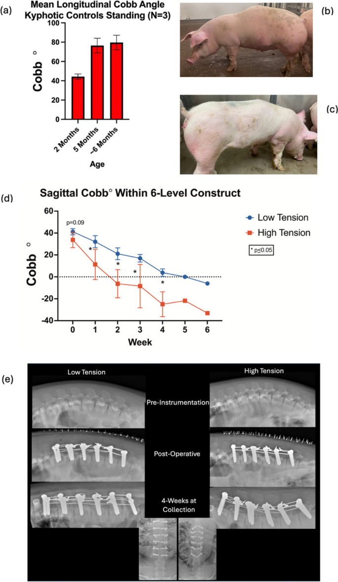The growth modulating effects of tether tension on vertebral growth are  biphasic: a study of posterior vertebral body tethering (pVBT) in a novel  kyphotic porcine model | Spine Deformity