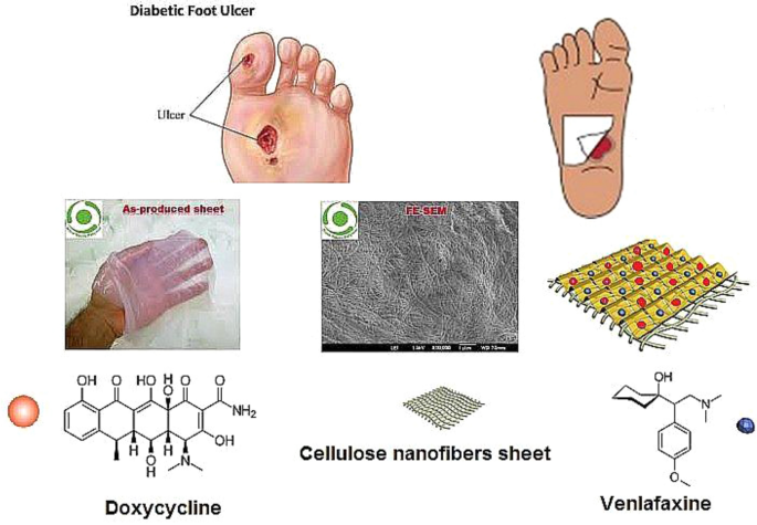 wet to dry dressing for diabetic foot ulcer