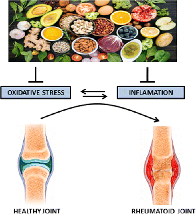 A Molecular Insight into Significance of Functional Foods in Better  Management of Rheumatoid Arthritis | Revista Brasileira de Farmacognosia |  Springer Nature Link