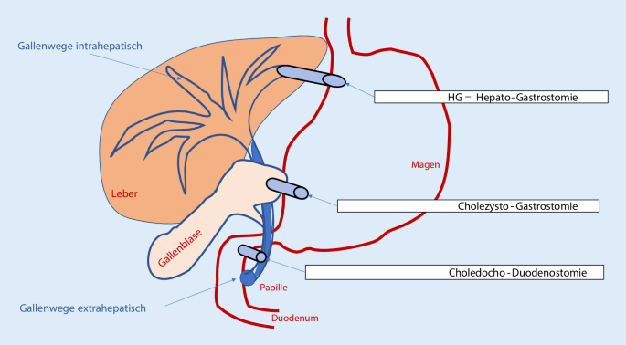 Die Flexible Endosonographie In Der Gastroenterologie Die Entwicklung Von Der Diagnostik Zur Therapie Springerlink