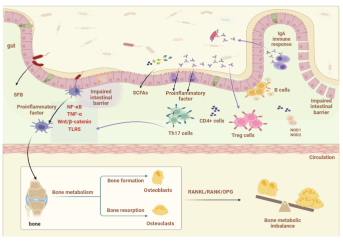 Regulatory Mechanisms of Gut Homeostasis and Bone Metabolism Interplay ...