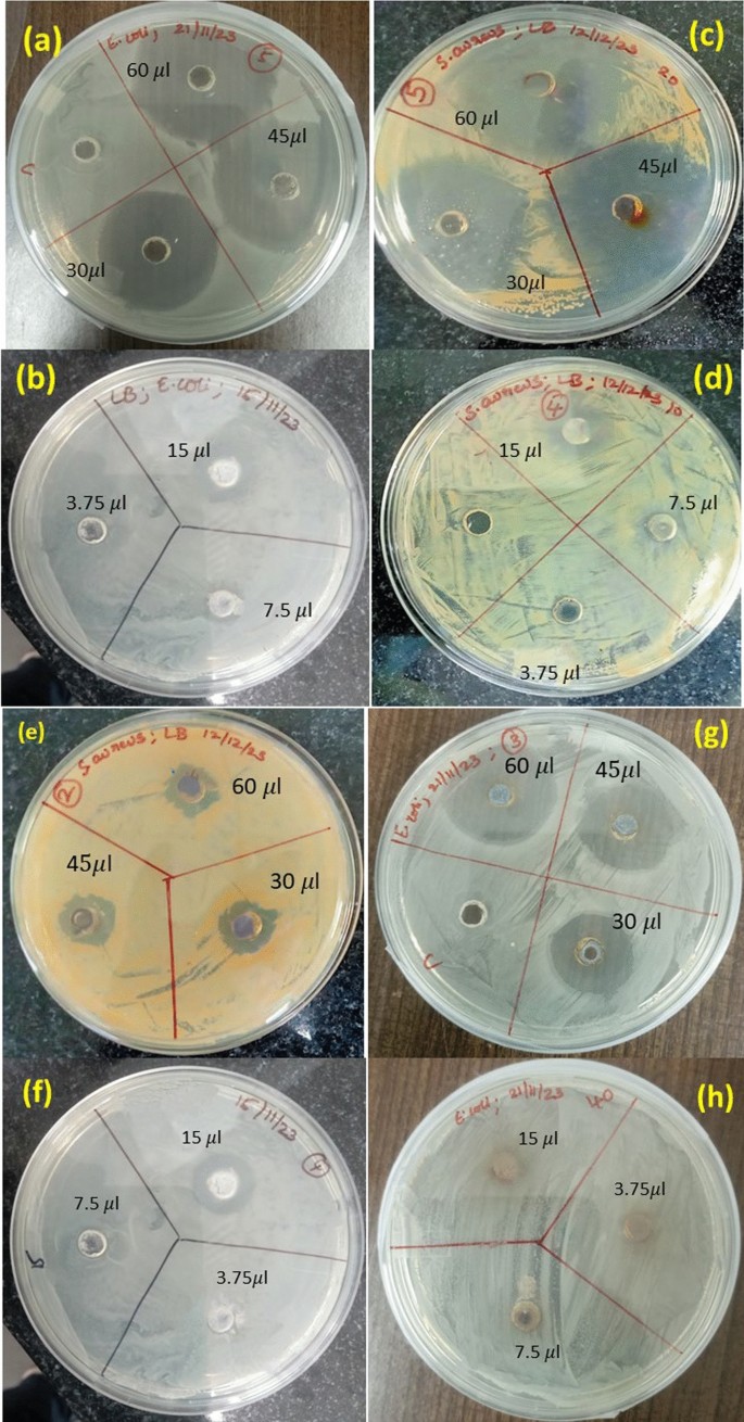 Antibacterial and photocatalytic activities of biosynthesized zinc ...